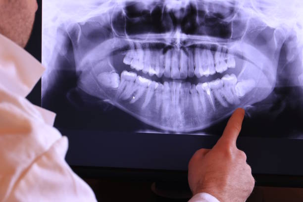 Best Emergency Treatment for Dental Infections or Abscesses in Hector, MN