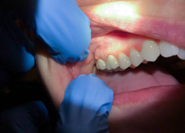 Best Pediatric Emergency Dentist in Hector, MN